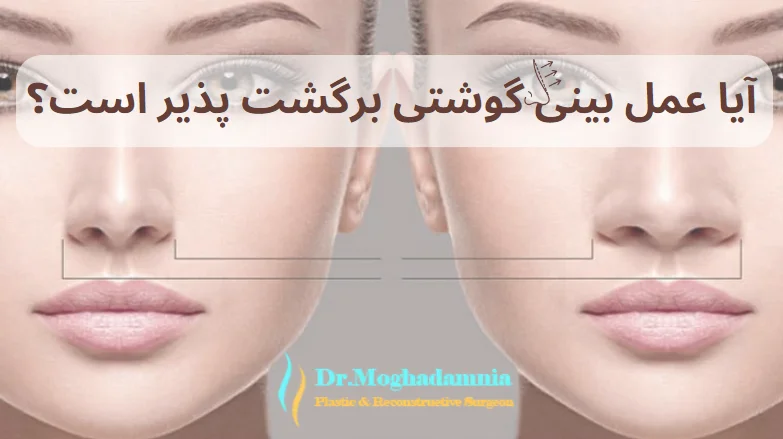عمل بینی گوشتی
