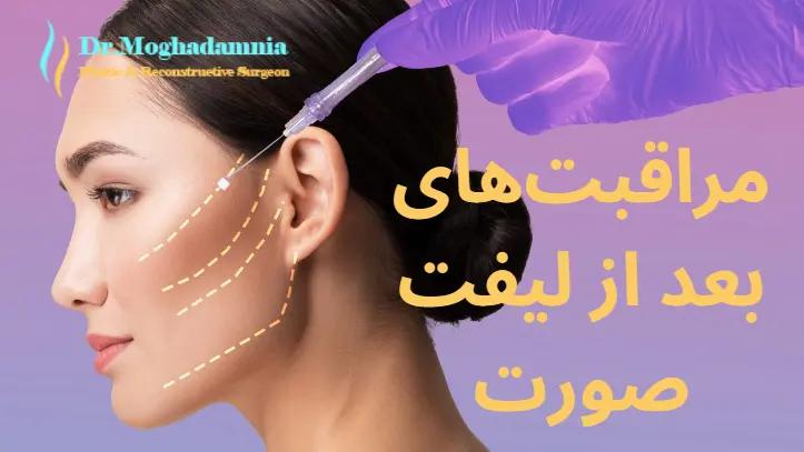 مراقبت‌های بعد از لیفت صورت
