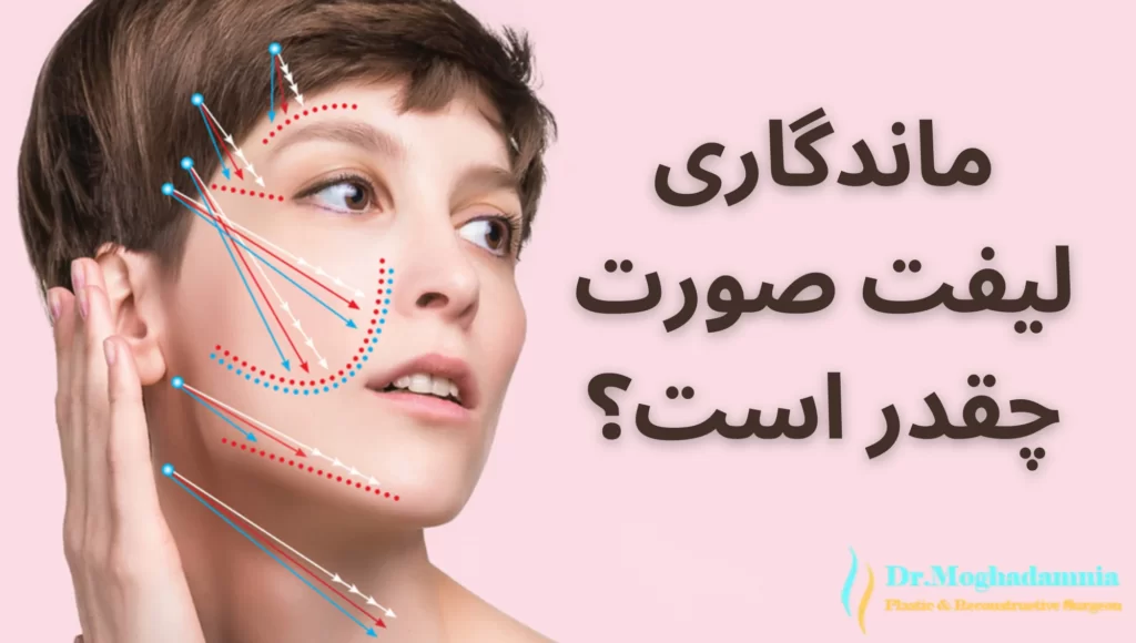 ماندگاری لیفت صورت چقدر است؟