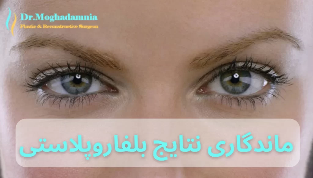 ماندگاری نتایج بلفاروپلاستی