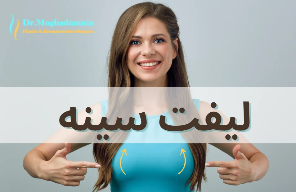 لیفت سینه