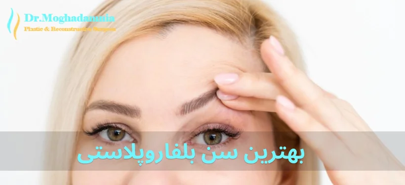 بهترین سن بلفاروپلاستی