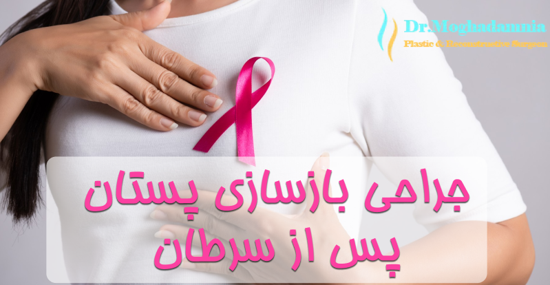 بازسازی پستان